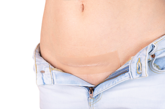 Dermaclar Siliconefusion C-Section Scar Patch